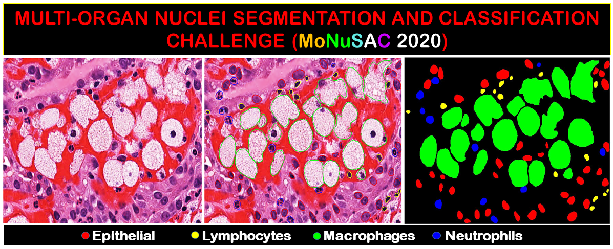 Histopathology slide showing staining for the four target cell types in MoNuSAC. Image courtesy of MoNuSAC, CC BY-NC 4.0