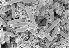 Scanning electron microscope image of the magnetic nanofactories attached to targeted E. coli cells.
