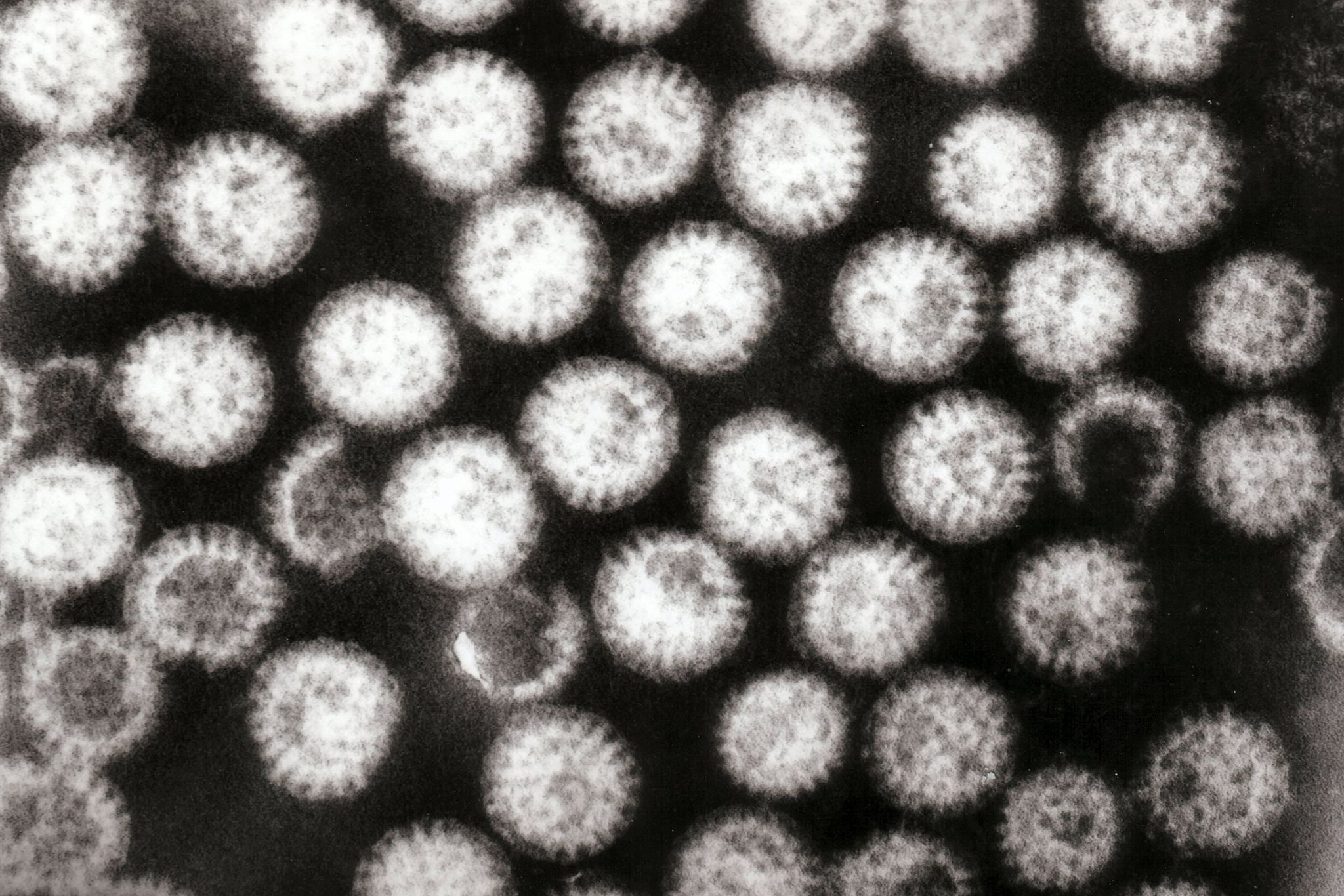 Transmission electron micrograph of multiple rotavirus particles. Credit: Dr. Graham Beards