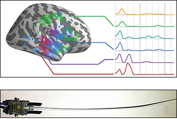 Top: Temporal response functions to natural speech vary across the brain (right hemisphere shown), with areas in the auditory cortex responding both quickly and repeatedly (last four temporal response functions), and areas outside of auditory cortex also responding but with a longer latency than auditory areas (first two temporal response functions). Credit: Christian Brodbeck, postdoctoral researcher, Institute for Systems Research, University of Maryland. From the “Neural source dynamics of brain responses to continuous stimuli with MEG: speech processing from acoustics to comprehension” presentation delivered at the Eighth International Workshop on Statistical Analysis of Neuronal Data (SAND8), May 31-June 2, 2017, University of Pittsburgh. Bottom: Animal whiskers are the inspiration for the development of novel sensors that use artificial whiskers made of advanced, custom-designed materials. The whiskers can sense object location, shape, and texture, to track fluid wakes in water, and to sense the direction of airflow. Credit: Bergbreiter laboratory, University of Maryland