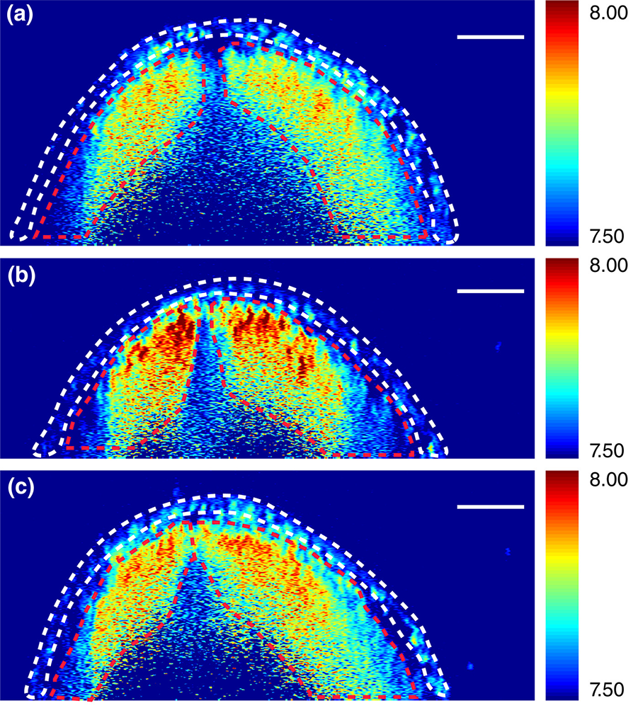 Brillouin images of neural tube cross sections at different levels within an embryo. DOI: 10.1002/bdr2.1389