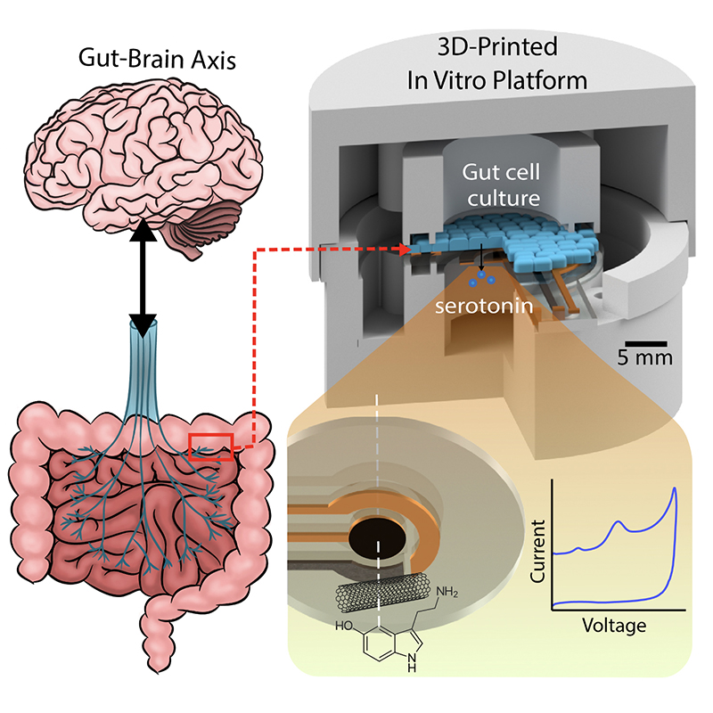 Symptoms all in your head—or in your gut? Maybe a...