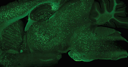 Histology image of Alzheimer’s disease in a mouse model showing amyloid plaques as bright green dots