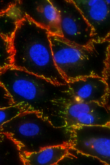 A microscopic image of tight junctions between human brain microvascular endothelial cells being opened by photodynamic priming.