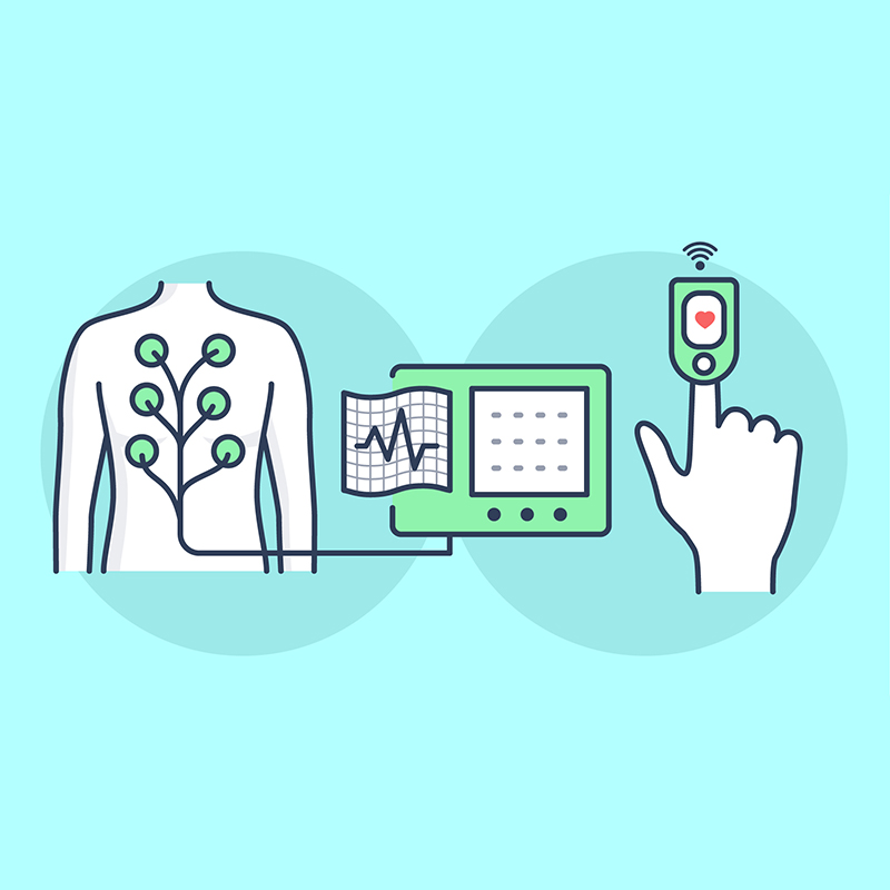 Heart monitoring via ECG or PPG systems