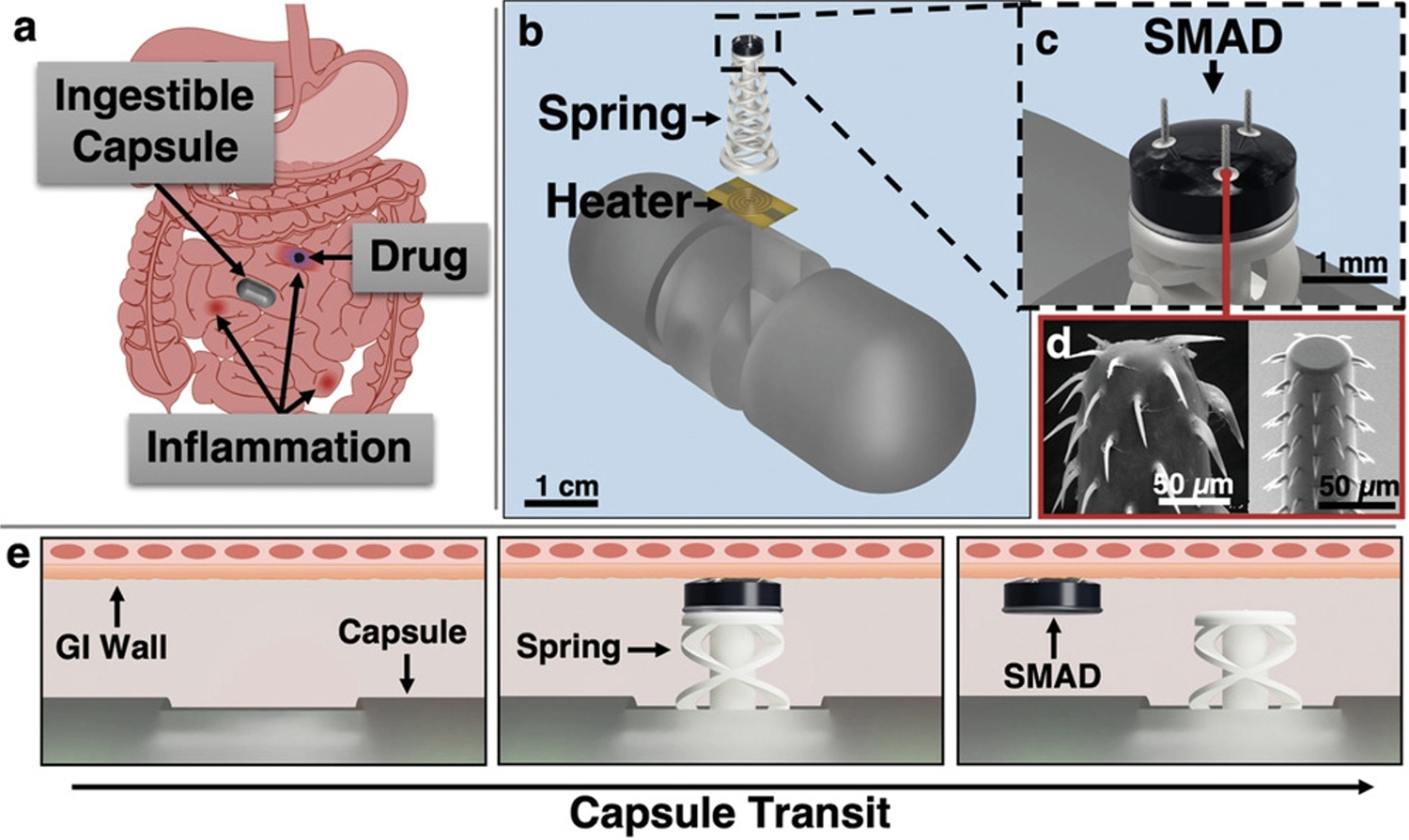 Figure 1 from the paper. (Click for larger view) This figure details the capsule's actuation and SMAD delivery principle. a) Capsule transits through a GI tract with inflammatory lesions and delivers the SMAD to an inflammatory site for prolonged release of a topical therapeutic agent (blue). b) Actuator deployment utilizes a resistive heating element to fire a spring actuator and impart the drug-loaded SMAD into the GI tissue. c) CAD rendering of the SMAD on the actuator. d) Spiny microneedles are designed to mimic a spiny-headed worm proboscis for enhanced anchoring in tissue: Reproduced under terms of the CC-BY license. e) Upon sensed or external command for SMAD delivery, current passes through the heating element, melting the polycaprolactone binder, and firing the spring. The SMAD is then imparted into the tissue and removes as the capsule translates through the intestinal tract.