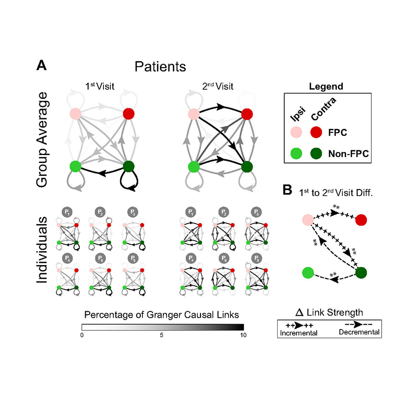 [Click image for larger view] At the six-month post-stroke second visit, stroke patients with improved cognitive scores demonstrated increased inter-hemispheric connectivity, similar to age-similar controls, that was not present at their first post-stroke visit, when they displayed clinical impairment acutely. (Fig. 3 from the research proposal)