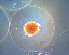 An islet of Langerhans (orange) encapsulated in an alginate bead measuring about 500 µm in diameter.