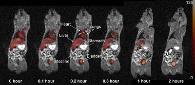A 19F MRI image from an earlier, similar study showing fluorinated imaging agents passing out of a mouse's system over time.