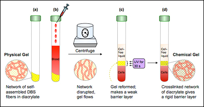 Mechanism for gelation of blood by hm-chitosan. On the left the polymer is shown schematically with its hydrophilic backbone in blue and the grafted benzyl-octadecyl hydrophobes in purple. When added to liquid blood, the components assemble into a three-dimensional network (gel), as shown on the right. This is driven by insertion of hydrophobes into blood cell membranes (as depicted in the top inset); thereby the polymer chains connect (bridge) the cells into a self-supporting network.