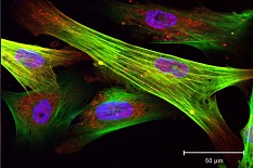 Seen through a microscope in Asst. Prof. Kan Cao's laboratory, these color-enhanced skin cells from progeria patients have been induced to become smooth muscle cells, some with abnormalities such as double nuclei. Image by Haoyue Zhang.