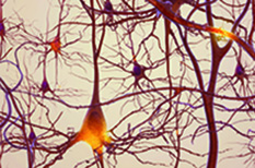 Neurons in the brain. Credit: National Institute on Aging/National Institutes of Health